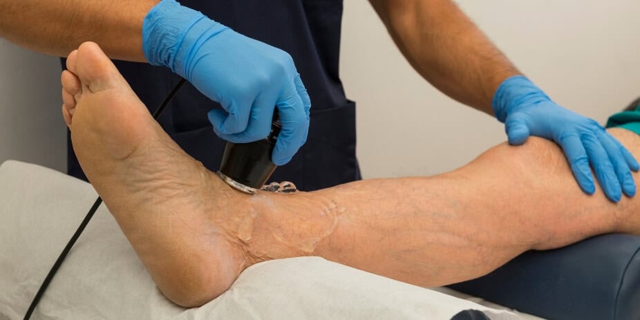 venous-leg-ultrasound-with-gel