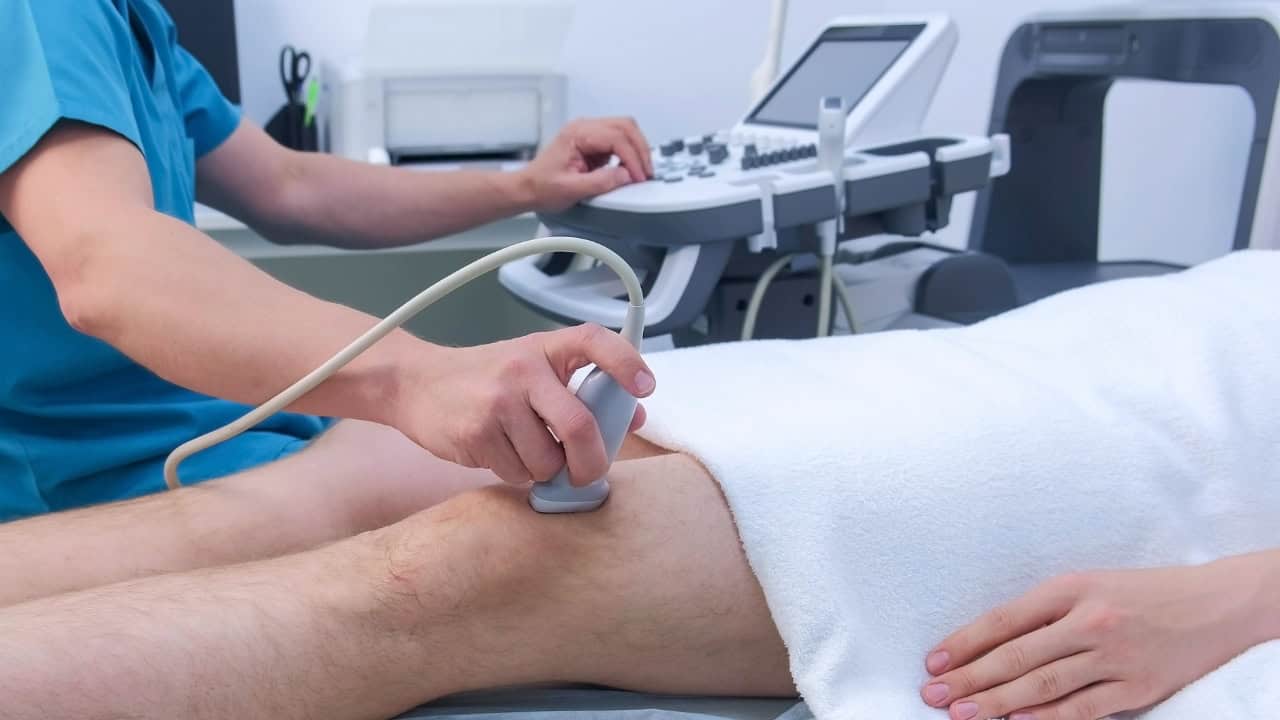 Leg vein ultrasound