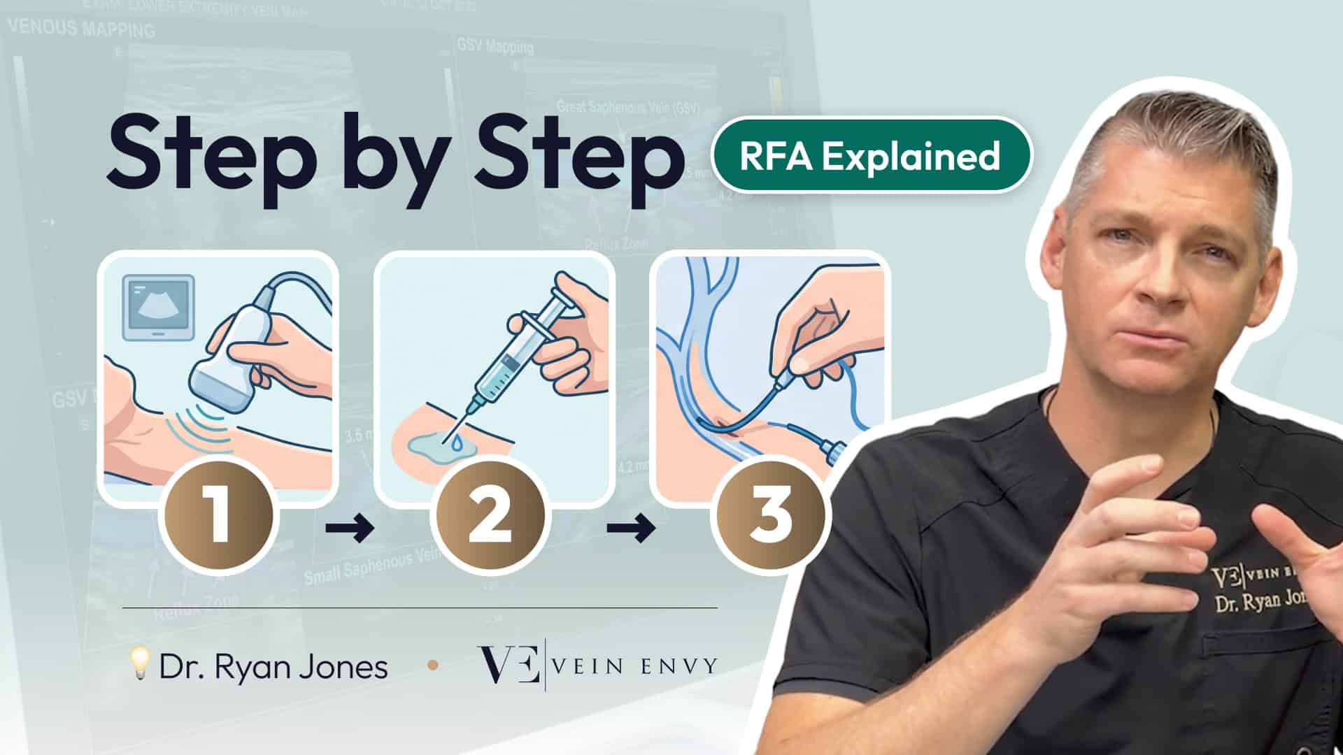 how does Radiofrequency ablation work